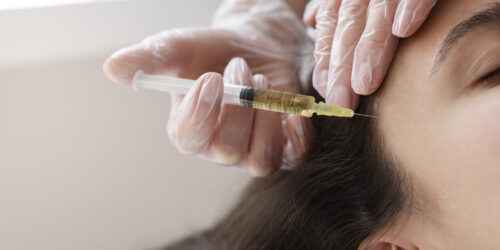 PRP Behandlung PRP Behandlung